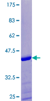 SPRR1A Protein - 12.5% SDS-PAGE of human SPRR1A stained with Coomassie Blue