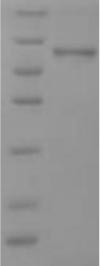 SPRR2B Protein - (Tris-Glycine gel) Discontinuous SDS-PAGE (reduced) with 5% enrichment gel and 15% separation gel.