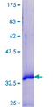 SPRR2F Protein - 12.5% SDS-PAGE of human SPRR2F stained with Coomassie Blue