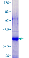SPRR2G Protein - 12.5% SDS-PAGE of human SPRR2G stained with Coomassie Blue