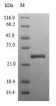 SPRR3 Protein - (Tris-Glycine gel) Discontinuous SDS-PAGE (reduced) with 5% enrichment gel and 15% separation gel.