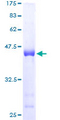 SPRR3 Protein - 12.5% SDS-PAGE of human SPRR3 stained with Coomassie Blue