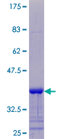 SPRR4 Protein - 12.5% SDS-PAGE of human SPRR4 stained with Coomassie Blue