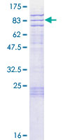 SPRTN / C1orf124 Protein - 12.5% SDS-PAGE of human C1orf124 stained with Coomassie Blue