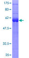 SPRY1 / Sprouty 1 Protein - 12.5% SDS-PAGE of human SPRY1 stained with Coomassie Blue