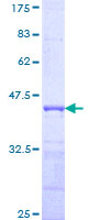 SPRY1 / Sprouty 1 Protein - 12.5% SDS-PAGE Stained with Coomassie Blue.