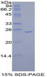 SPRY1 / Sprouty 1 Protein - Recombinant Sprouty Homolog 1 By SDS-PAGE