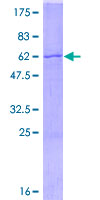 SPRY2 / Sprouty 2 Protein - 12.5% SDS-PAGE of human SPRY2 stained with Coomassie Blue