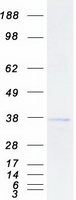 SPRY2 / Sprouty 2 Protein - Purified recombinant protein SPRY2 was analyzed by SDS-PAGE gel and Coomassie Blue Staining