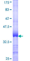SPRYD3 Protein - 12.5% SDS-PAGE Stained with Coomassie Blue.