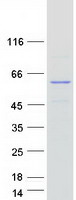 SPRYD3 Protein - Purified recombinant protein SPRYD3 was analyzed by SDS-PAGE gel and Coomassie Blue Staining