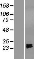 SPRYD4 Protein - Western validation with an anti-DDK antibody * L: Control HEK293 lysate R: Over-expression lysate