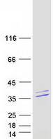 SPRYD4 Protein - Purified recombinant protein SPRYD4 was analyzed by SDS-PAGE gel and Coomassie Blue Staining