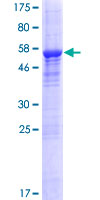 SPRYD5 Protein - 12.5% SDS-PAGE of human SPRYD5 stained with Coomassie Blue