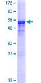 SPRYD5 Protein - 12.5% SDS-PAGE of human SPRYD5 stained with Coomassie Blue