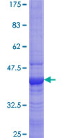 SPRYD7 / C13orf1 Protein - 12.5% SDS-PAGE of human C13orf1 stained with Coomassie Blue