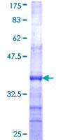 SPRYD7 / C13orf1 Protein