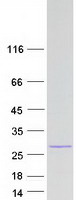 SPRYD7 / C13orf1 Protein - Purified recombinant protein SPRYD7 was analyzed by SDS-PAGE gel and Coomassie Blue Staining