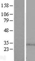 SPSB1 Protein - Western validation with an anti-DDK antibody * L: Control HEK293 lysate R: Over-expression lysate