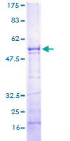 SPSB1 Protein - 12.5% SDS-PAGE of human SSB1 stained with Coomassie Blue