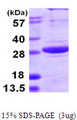 SPSB1 Protein