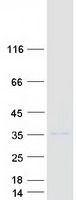 SPSB1 Protein - Purified recombinant protein SPSB1 was analyzed by SDS-PAGE gel and Coomassie Blue Staining