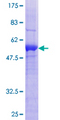 SPSB2 Protein - 12.5% SDS-PAGE of human SPSB2 stained with Coomassie Blue
