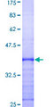 SPSB2 Protein - 12.5% SDS-PAGE Stained with Coomassie Blue.