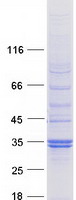 SPSB2 Protein - Purified recombinant protein SPSB2 was analyzed by SDS-PAGE gel and Coomassie Blue Staining