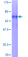 SPSB3 Protein - 12.5% SDS-PAGE of human SPSB3 stained with Coomassie Blue