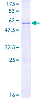 SPSB4 Protein - 12.5% SDS-PAGE of human SPSB4 stained with Coomassie Blue