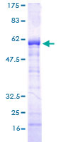 SPT3 / SUPT3H Protein - 12.5% SDS-PAGE of human SUPT3H stained with Coomassie Blue