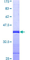 SPT5 / SUPT5H Protein - 12.5% SDS-PAGE Stained with Coomassie Blue.