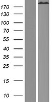 SPTA1 / Alpha Spectrin Protein - Western validation with an anti-DDK antibody * L: Control HEK293 lysate R: Over-expression lysate
