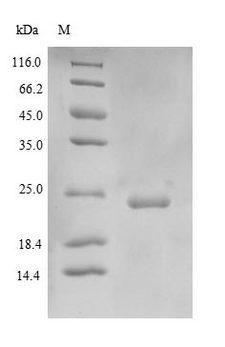 SPTAN1 / Alpha Fodrin Protein - (Tris-Glycine gel) Discontinuous SDS-PAGE (reduced) with 5% enrichment gel and 15% separation gel.