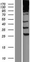 SPTBN1 / ELF Protein - Western validation with an anti-DDK antibody * L: Control HEK293 lysate R: Over-expression lysate