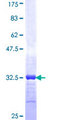 SPTBN2 Protein - 12.5% SDS-PAGE Stained with Coomassie Blue.