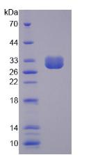 SPTBN4 Protein - Recombinant Spectrin Beta, Non Erythrocytic 4 By SDS-PAGE