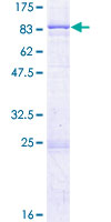 SPTLC2 / LCB2 Protein - 12.5% SDS-PAGE of human SPTLC2 stained with Coomassie Blue