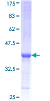 SPTLC2 / LCB2 Protein - 12.5% SDS-PAGE Stained with Coomassie Blue.