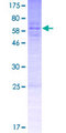 SPY1 / SPDYA Protein - 12.5% SDS-PAGE of human SPDYA stained with Coomassie Blue