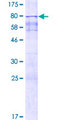 SPZ1 Protein - 12.5% SDS-PAGE of human SPZ1 stained with Coomassie Blue