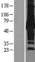 SQSTM1 Protein - Western validation with an anti-DDK antibody * L: Control HEK293 lysate R: Over-expression lysate