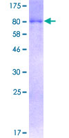 SQSTM1 Protein - 12.5% SDS-PAGE of human SQSTM1 stained with Coomassie Blue