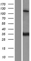 SR140 / U2SURP Protein - Western validation with an anti-DDK antibody * L: Control HEK293 lysate R: Over-expression lysate