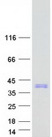 SRA1 / SRA Protein - Purified recombinant protein SRA1 was analyzed by SDS-PAGE gel and Coomassie Blue Staining