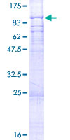 SRBD1 Protein - 12.5% SDS-PAGE of human SRBD1 stained with Coomassie Blue