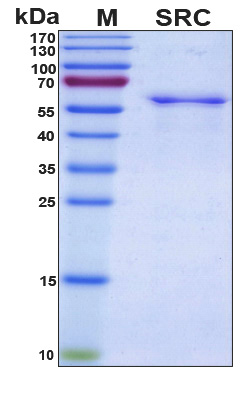 SRC Protein - SDS-PAGE under reducing conditions and visualized by Coomassie blue staining