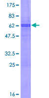 SRCIN1 / SNIP Protein - 12.5% SDS-PAGE of human SNIP stained with Coomassie Blue