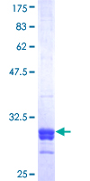 SRD5A2 Protein - 12.5% SDS-PAGE Stained with Coomassie Blue.